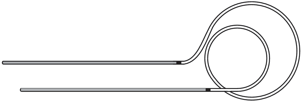 Dacryocystorhinostomy (Dcr)